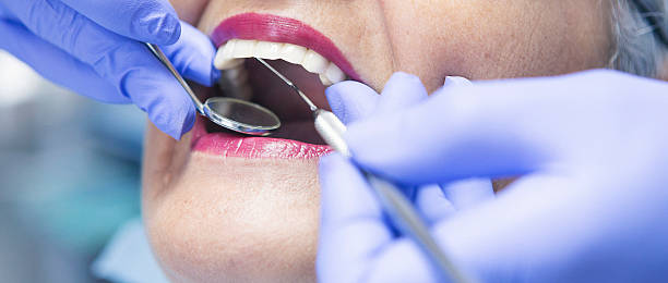 Best Knocked-Out Tooth Emergency  in Westfield, WI